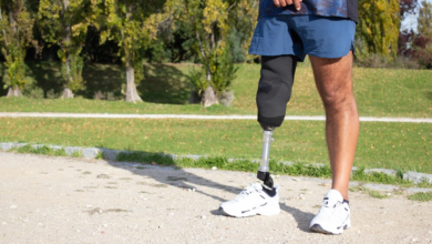 The Importance of Personalization in a Custom Prosthetic Leg