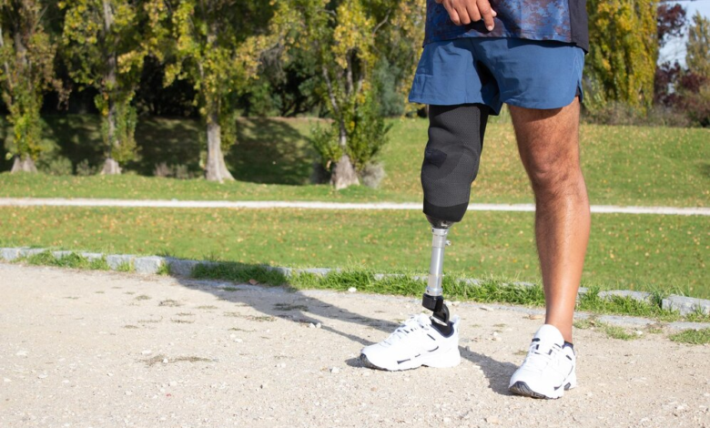 The Importance of Personalization in a Custom Prosthetic Leg