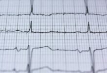 endless business data flow